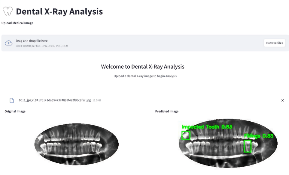 Dental X-Ray Analysis Platform